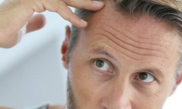 New Hair Treatment vs. Hair Vitalizing Treatment