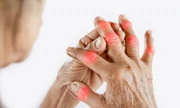 Use homeopathy to ease gout pains