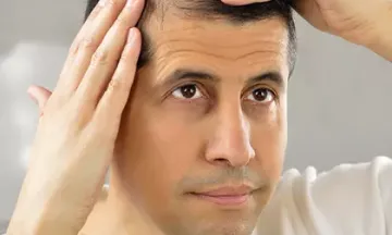 What is the best hair fall treatment for men?