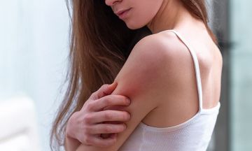 5 things to know before skin allergy treatment