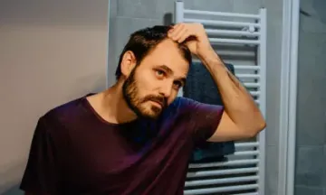How to know if you have male pattern baldness?