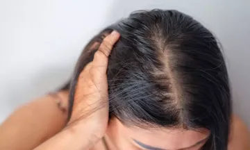 5 reasons behind winter hair fall and how to deal with it  Be Beautiful  India