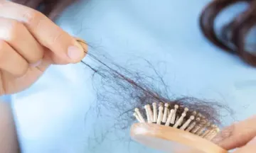 Wave Goodbye to Female Pattern Baldness with Homeopathy