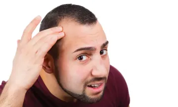 Hair Loss in Teens