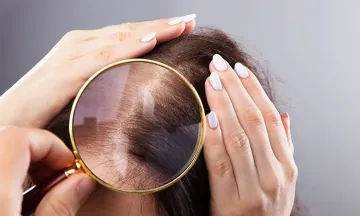 How does non-surgical hair replacement work?