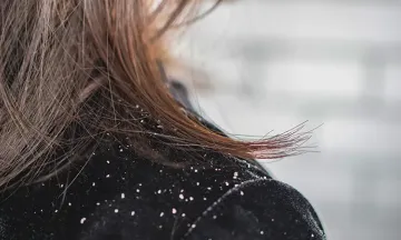 How to control dandruff with Dr Batra's® New Hair treatment?