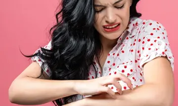 How to get rid of skin allergies?