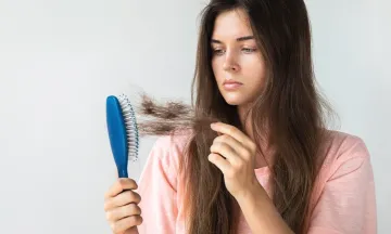 3 Main reasons for hair loss and its prevention plan
