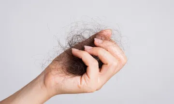 Effective Home Remedies to Control Hair Loss