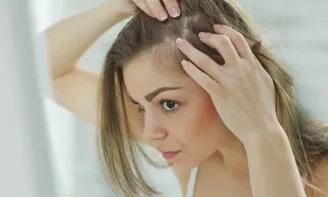 Early warning signs of female pattern baldness - are you at risk?
