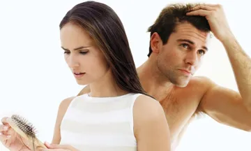 How women perceive men with Hair Loss?