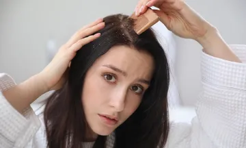 Is hair care regime to be blamed for Dandruff?