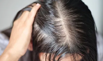 An ounce of prevention of Hair thinning is worth a pound of cure...