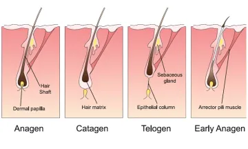 What is Hairfall? Why Homoeopathy?