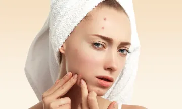 Is Your Acne Worse in Summer?