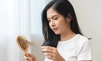 Does Dengue Fever Cause Hair Loss? Understand the Connection and Treatment