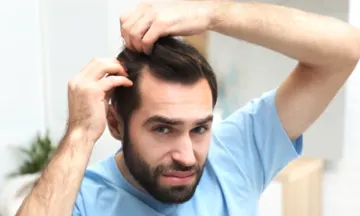 DHT Hair Loss in Men: Hair Loss, Blockers & Natural Solutions