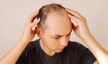 grooming-tips-bald-look-summer