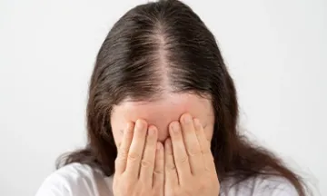 Causes of Female Pattern Baldness – Know the Reasons Behind Hair Loss in Women