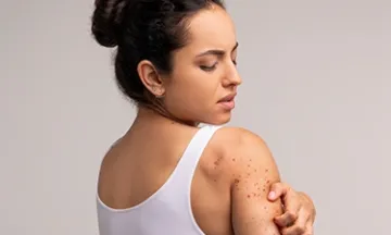 Remedy for itchy skin at night