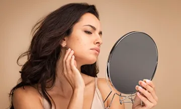 Can skin stress lead to pimples?
