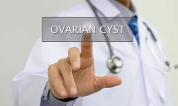 Ovary Cyst and Hair loss – What’s the link?