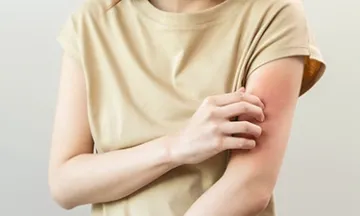 Reasons for Whole Body Itching: Causes and Relief Tips for Itchy Skin