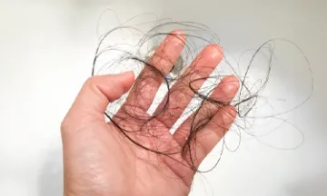 Home remedies to prevent hair fall in monsoon
