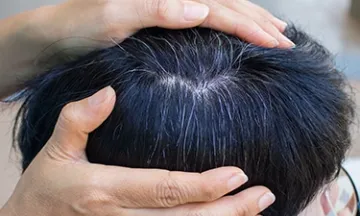 Should You Worry If Your Child Has Grey Hair?