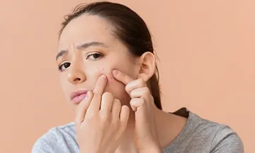 Acne Causes – What Triggers Those Recurrent Breakouts?