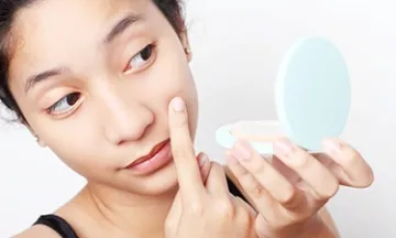 Teenage acne: when it’s time to see a doctor?