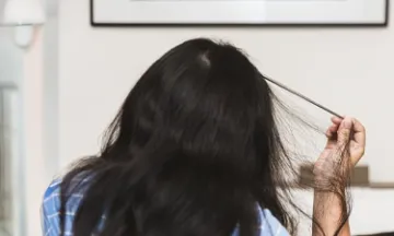 Trichotillomania: Symptoms & Treatments