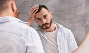 What are the types of hair loss seen in men?