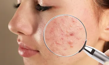 10 most common skin disorders