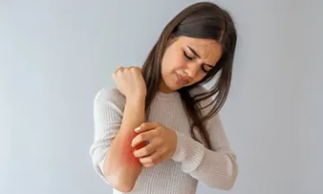 What to do if you have a skin allergy?