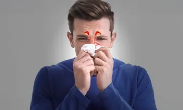 What is Sinusitis, Its Types & Homeopathy Treatment