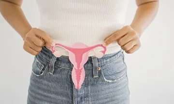 PCOS 