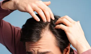 early signs for hair loss