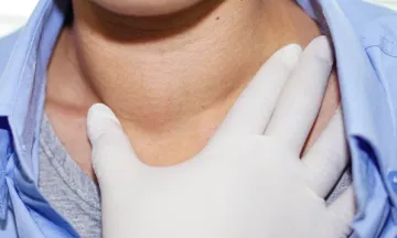 Hyperthyroidism
