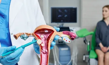 Fibroids uterus