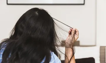 trichotillomania