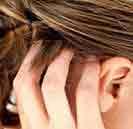 Scalp Psoriasis Treatment in Homeopathy