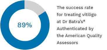 Success Rate of Treating Vitiligo at Dr.Batra’s Clinic