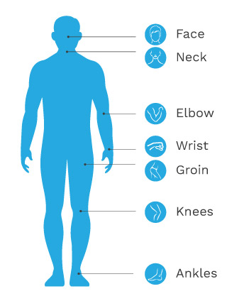 Eczema common site