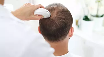 Hair Fall Treatment