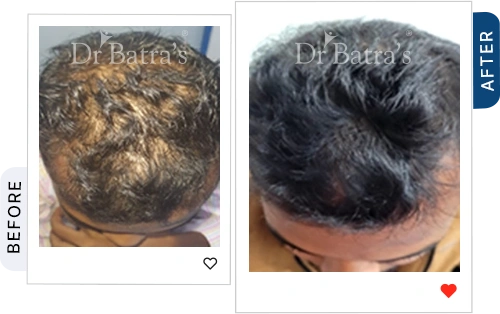 01 Before After