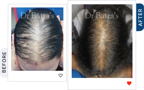 02 Before After