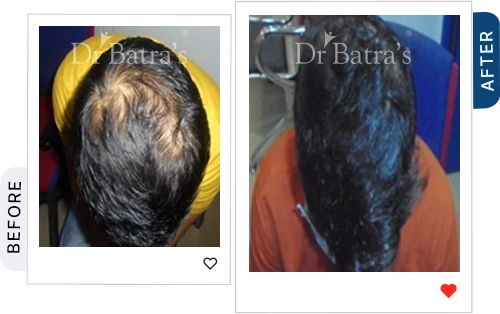 03 Before After