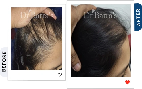 04 Before After