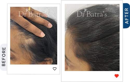 05 Before After